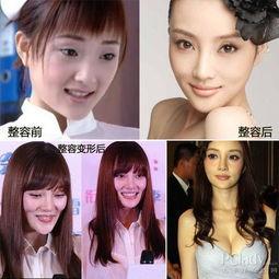 西安整容爆料事件视频最新,揭秘行业乱象，患者权益引关注